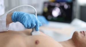 2D-Echocardiograms