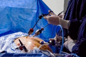Operating and Delivery Room
