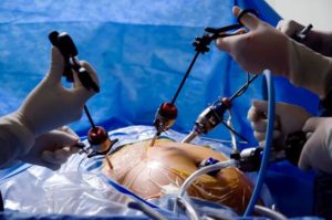 Operating and Delivery Room