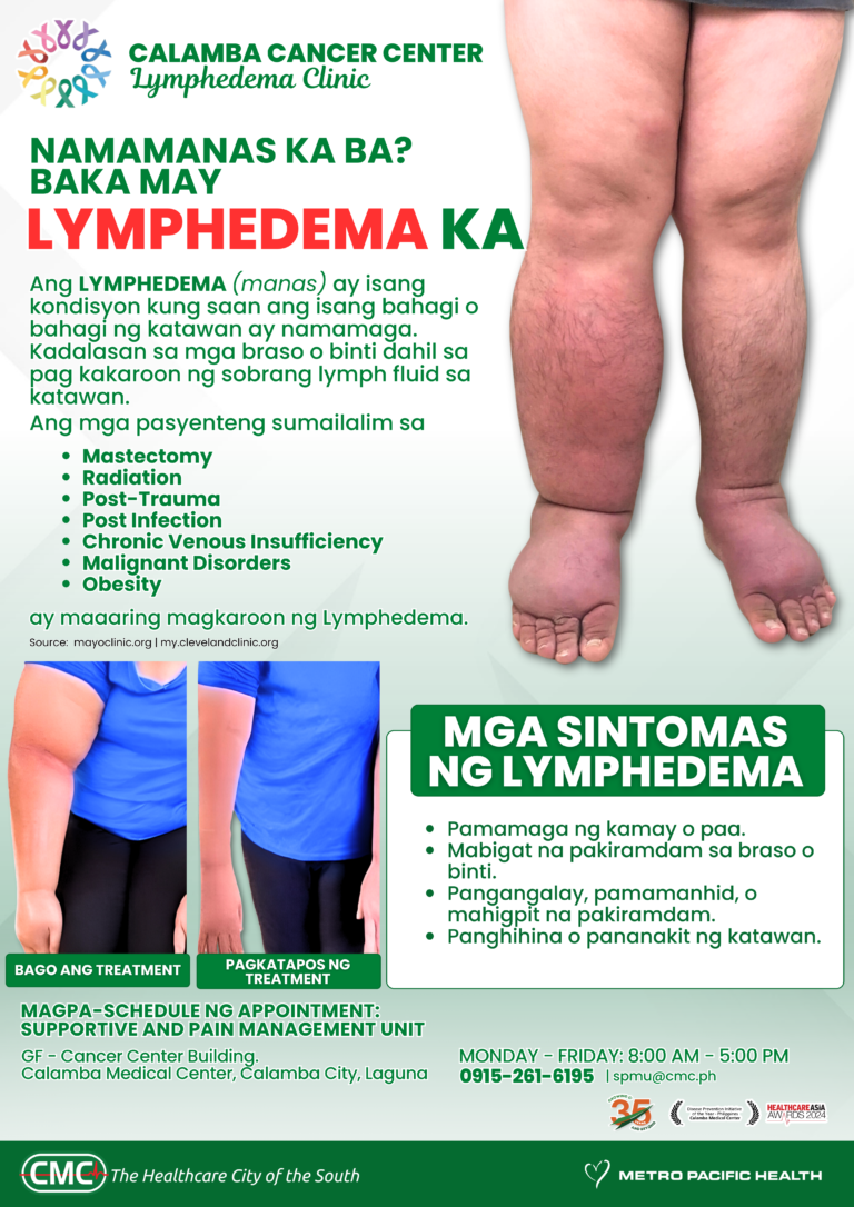 LYMPHEDEMA (Document (A4)) (1)