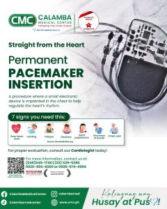 PAcemaker