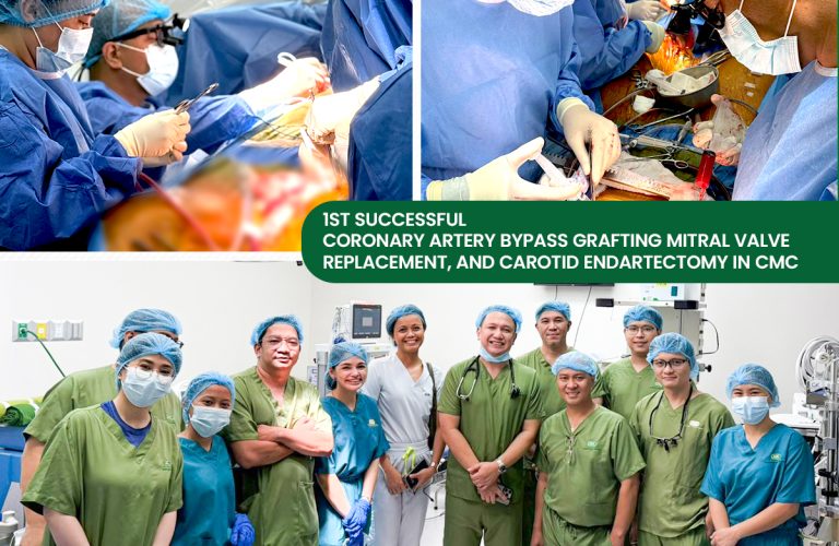 1ST CABG POSTER copy