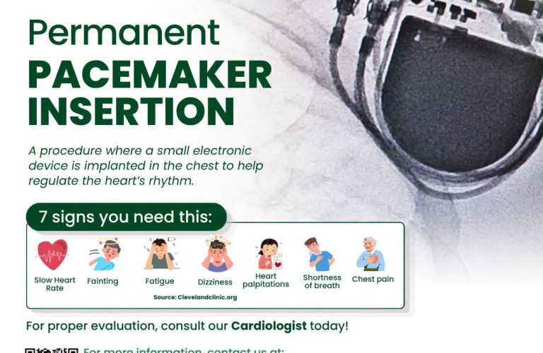 PAcemaker