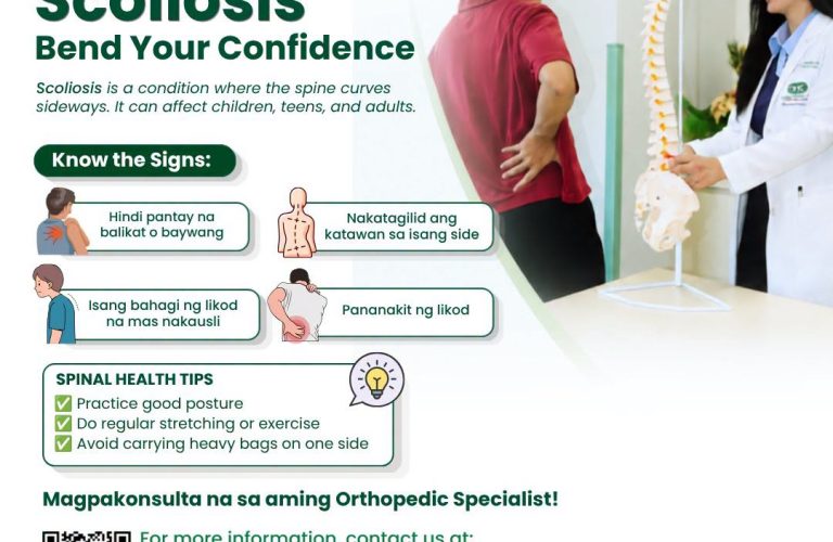 scoliosis
